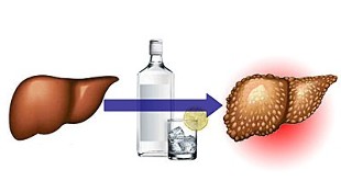 alkohola ietekme uz aknām